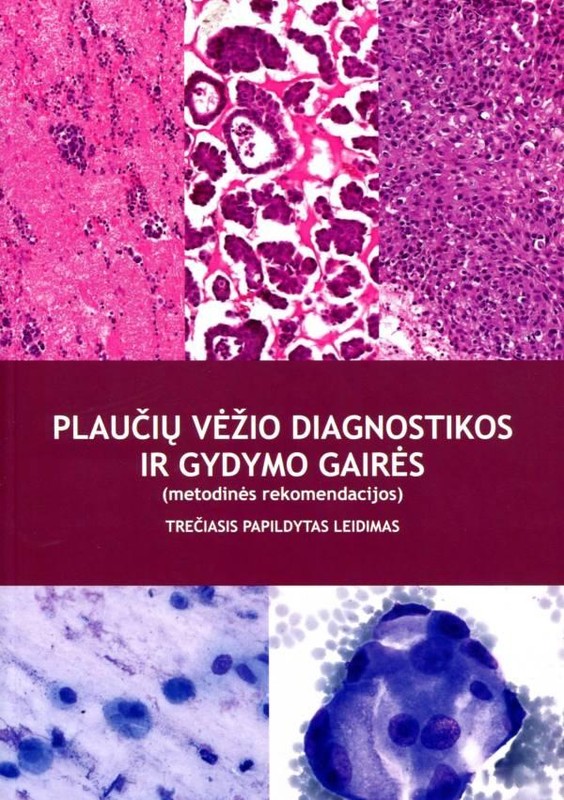 Plaučių vėžio diagnostikos ir gydymo gairės (3-as leidimas)