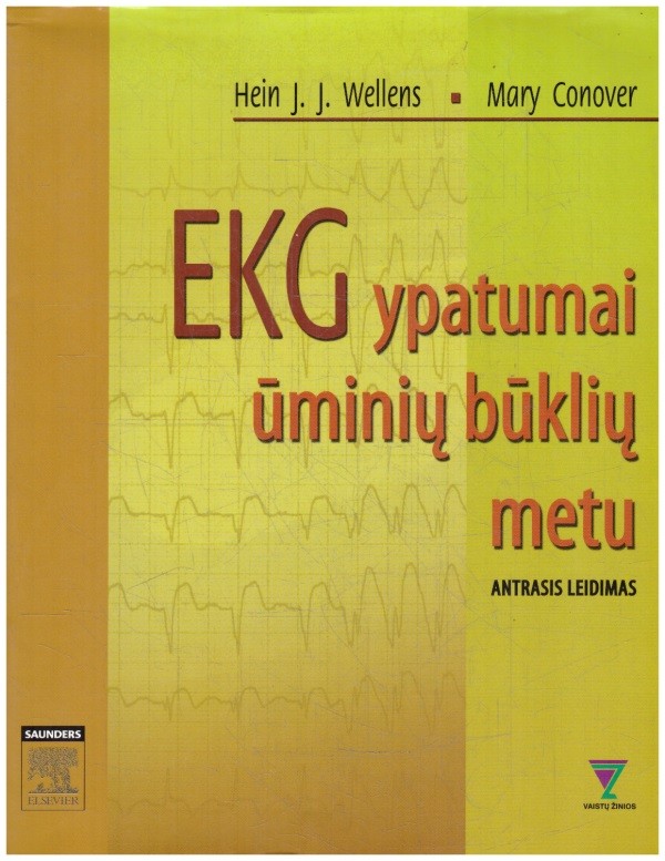 EKG ypatumai ūminių būklių metu