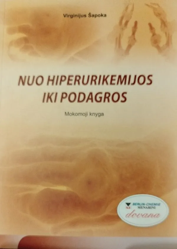 Nuo hiperukemijos iki podagros