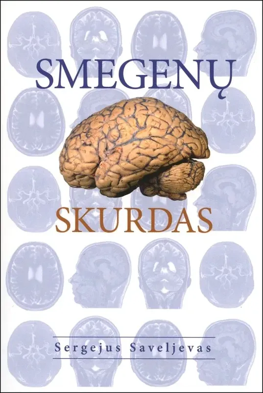 Smegenų skurdas